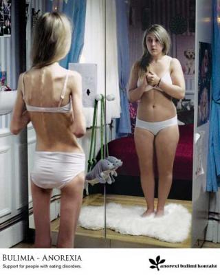 anorexia en jovenes